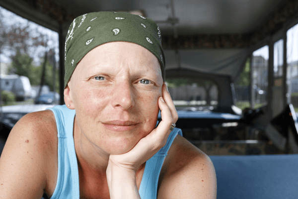 Deal with Hair Loss When Undergoing Chemo