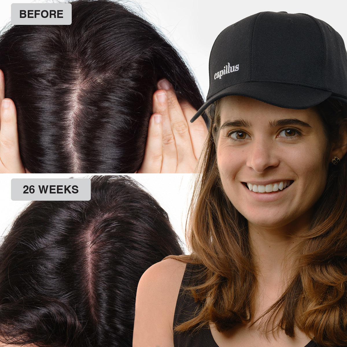 Top: Person showing thinning hair at the scalp labeled “BEFORE.” Bottom: Same person with fuller hair after “26 WEEKS,” smiling and wearing a black Capillus cap.