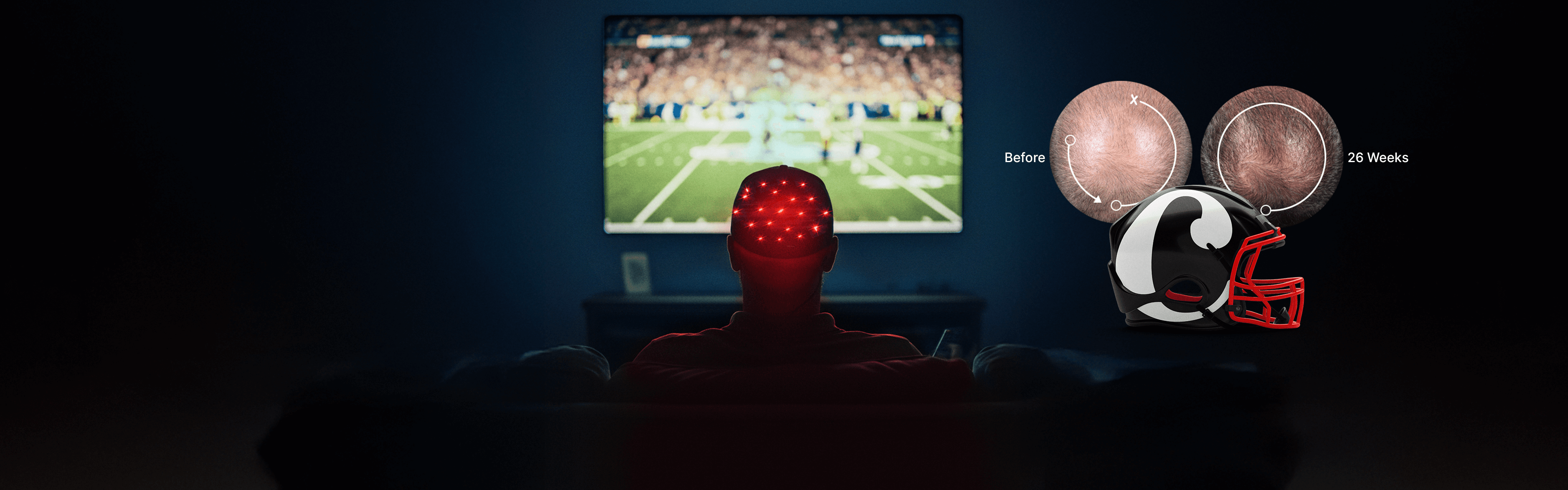 A person with red lights on their scalp watches football on TV; inset shows close-up images of a scalp Before and 24 Weeks with a football helmet illustration between them.