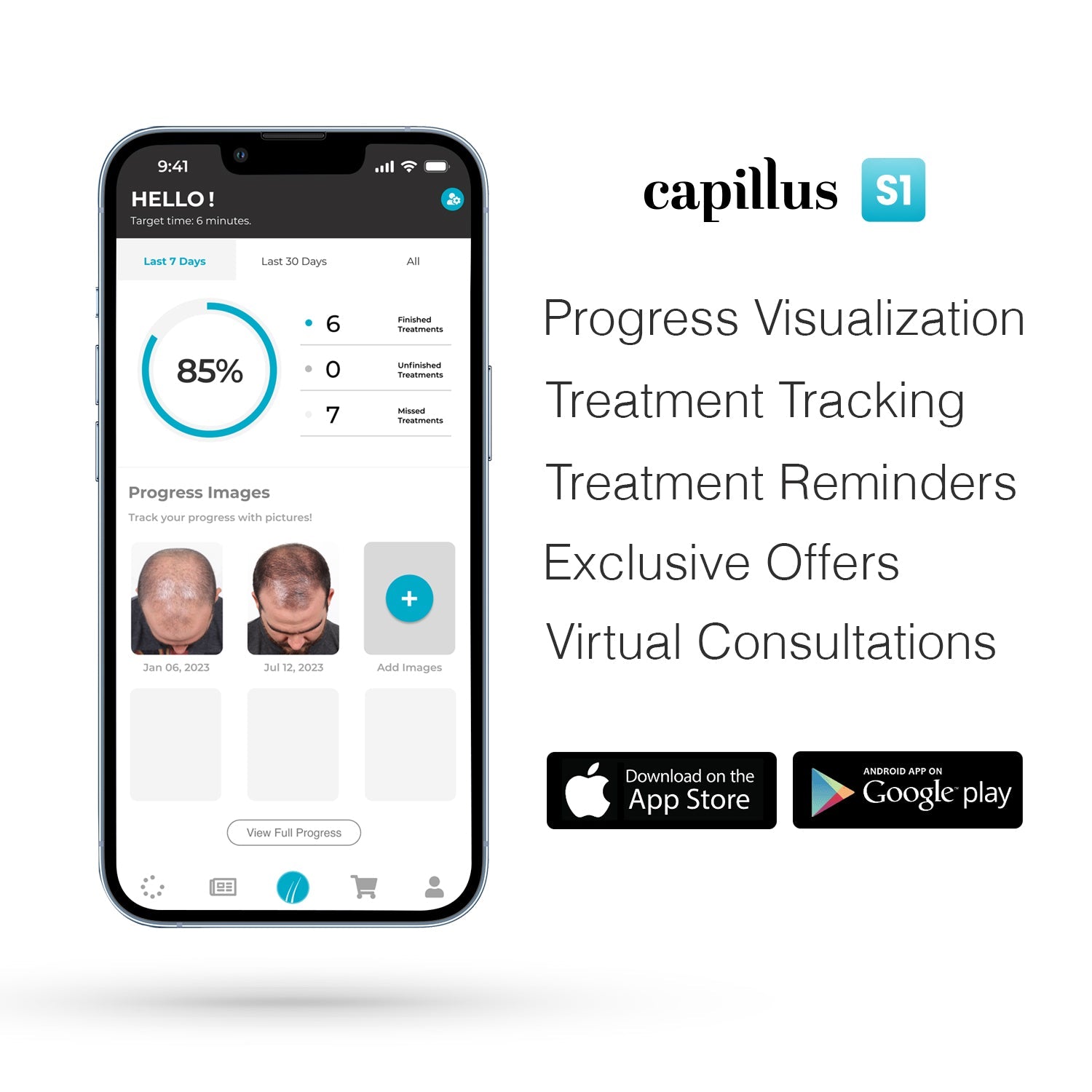 Capillus PRO S2