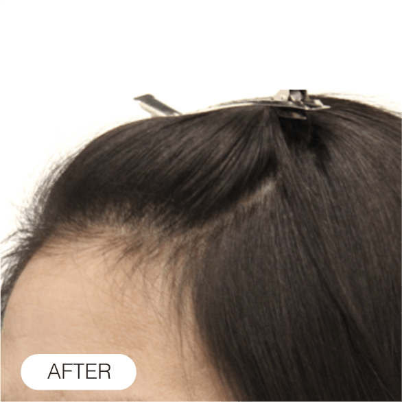 After