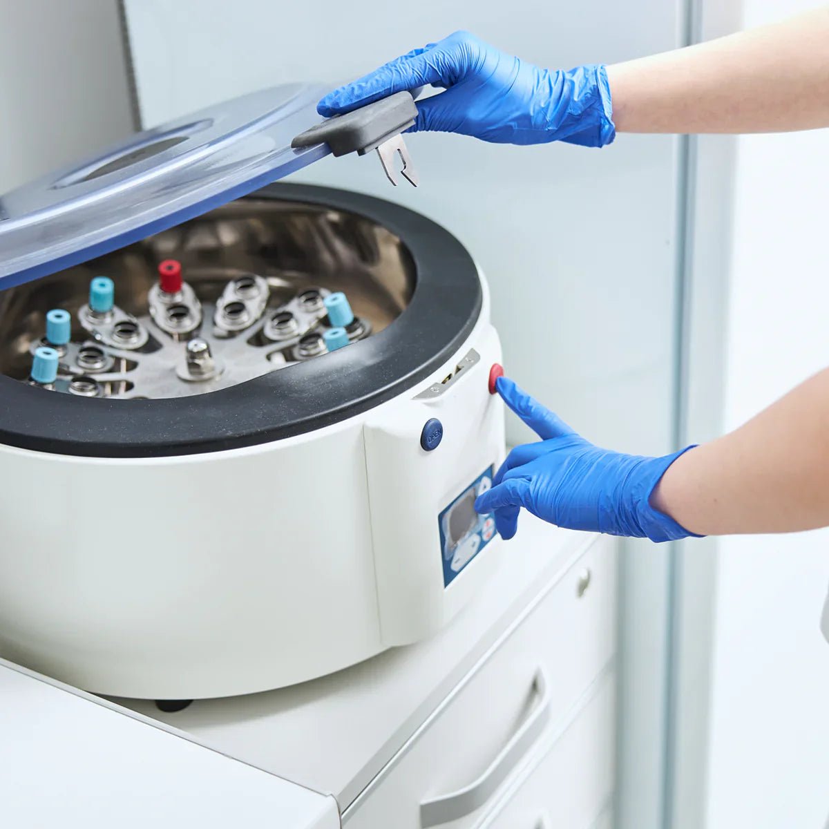 PRP Hair Loss Treatment