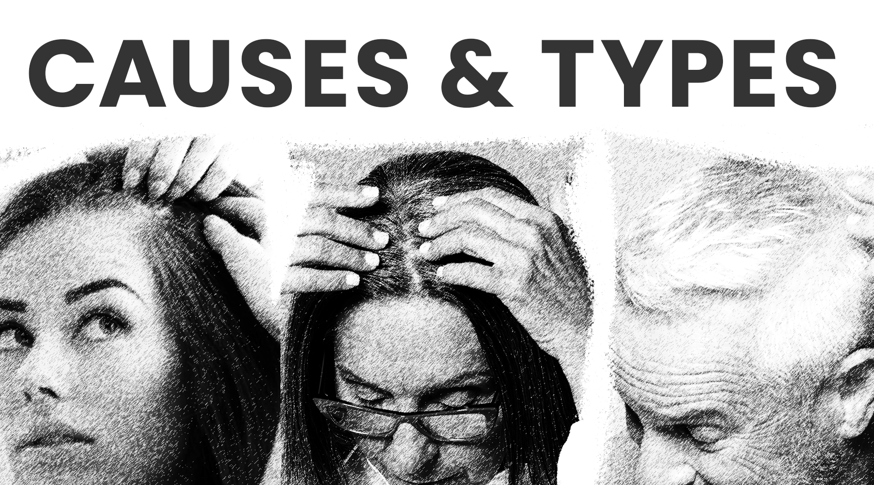 Types and Causes of Thinning Hair