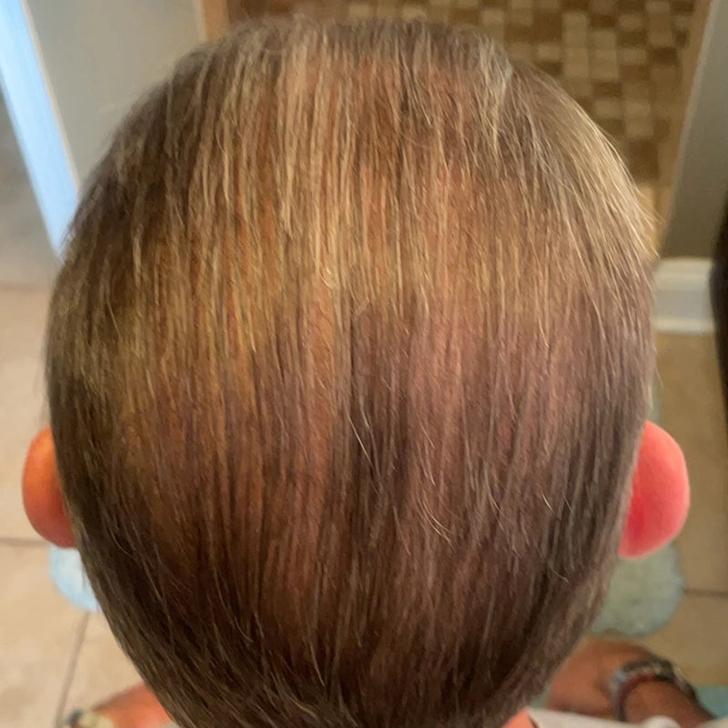 Top view of a persons head with thinning hair and visible scalp, showing some hair loss. The background includes tiled flooring and a bathroom area.