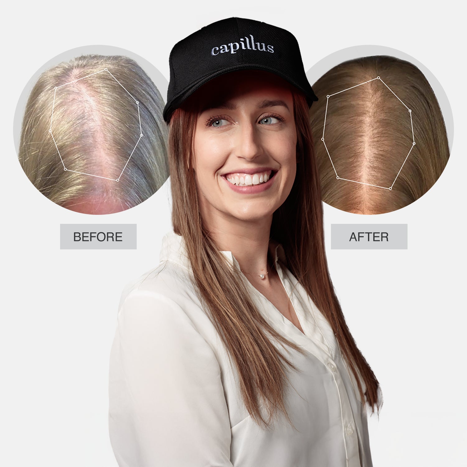 Hair therapy cap sales