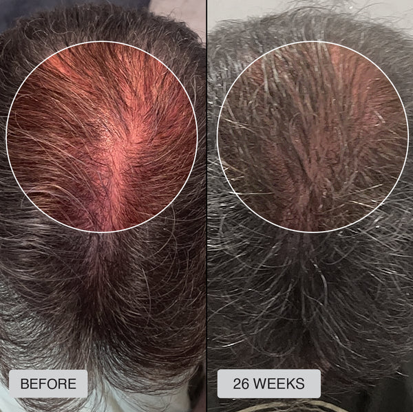 Billy - Before After