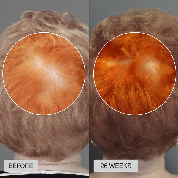 Joan - Before After