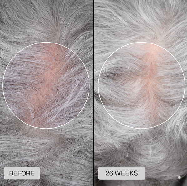 Maria - Before After
