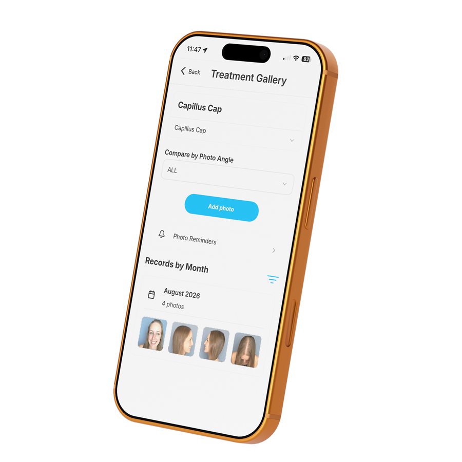 Capillus app progress screen