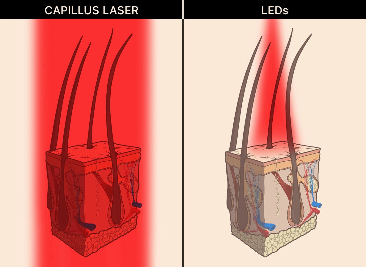 Side-by-side illustration comparing Capillus laser (left) with LEDs (right) for hair treatment, showing deeper red light penetration in skin with Capillus laser versus more superficial penetration with LEDs.