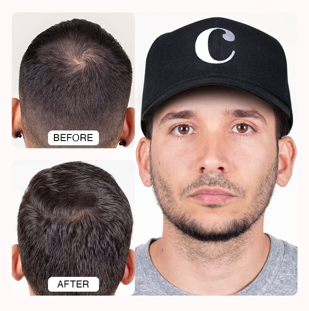 Capillus Spectrum Laser Cap for Hair Growth: Stop the Hair Loss with Capillus Hat - Best ...