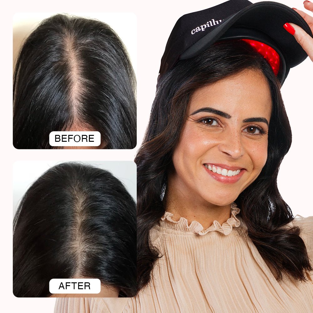 Capillus Spectrum Laser Cap for Hair Growth: Stop the Hair Loss with Capillus Hat - Best ...