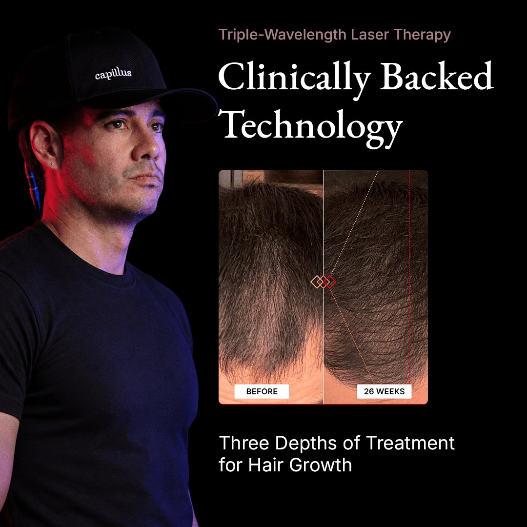 Un homme portant un casque laser Capillus TriSpectrum noir destiné à la repousse des cheveux, à côté d'une comparaison « avant-après » montrant une amélioration de la densité capillaire après 26 semaines.