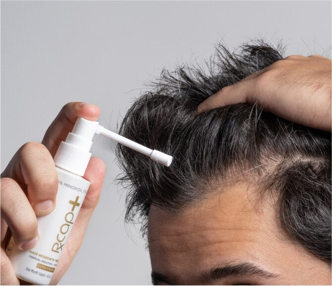 Minoxidil 5% for Men - Extra Strength Hair Treatment - Capillus