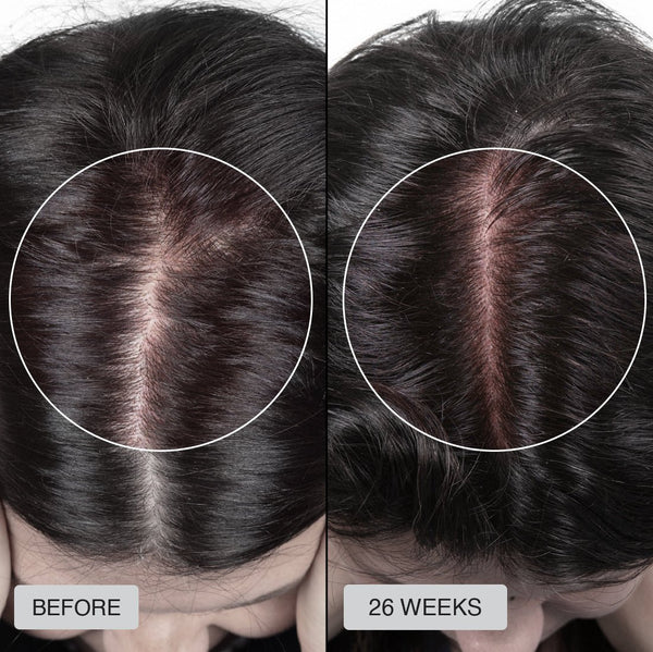 Ana - Before After